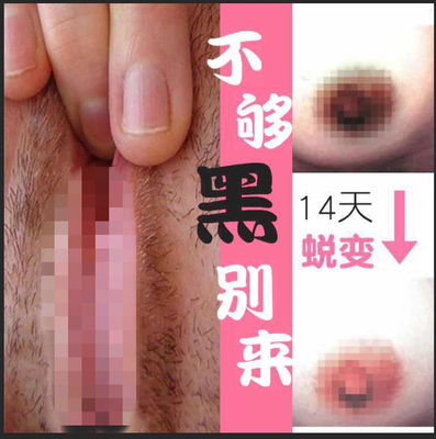 私处美白去黑色素淡化乳头乳晕嘴唇腋下私密处粉嫩保养紧致嫩红素-淘宝网