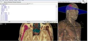 3D人体断层解剖软件 中英双语/断层医学影像CT MRI解剖学软件合集