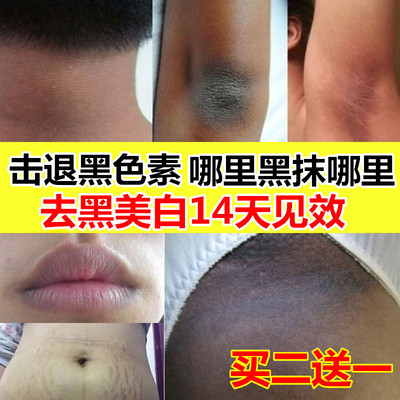 私处美白粉嫩去除腋下黑色素沉淀淡化脸部嘴唇乳晕乳头私密嫩红素-淘宝网