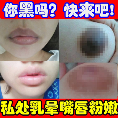 嫩红素去淡化乳晕乳头腋下全身粉嫩私密处护理外阴黑色素私处美白-淘宝网