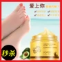 Chân kem dưỡng ẩm chân chống khô cho da chết gót chân sửa chữa kem massage lột tẩy da chết kem trị nứt nẻ chân tay