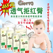 Tã quần Giotto tã kéo co giãn siêu mỏng tã đa năng hộp 6 gói có thể sử dụng với người mẫu