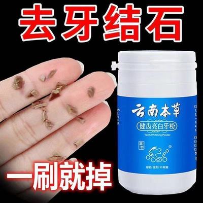 【我很大瓶150ml 不白退全款】洁牙慕斯牙齿美白脱色剂去黄洗牙粉