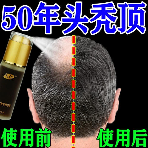 Водостойкий шампунь, увеличивающий лосьон для волос для роста волос, против выпадения волос, в составе Горец многоцветковый