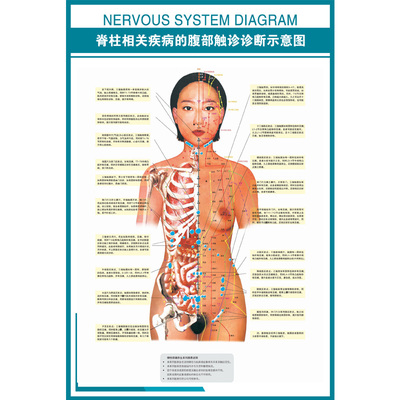 医院医学挂图 脊柱相关疾病的腹部触诊诊断示