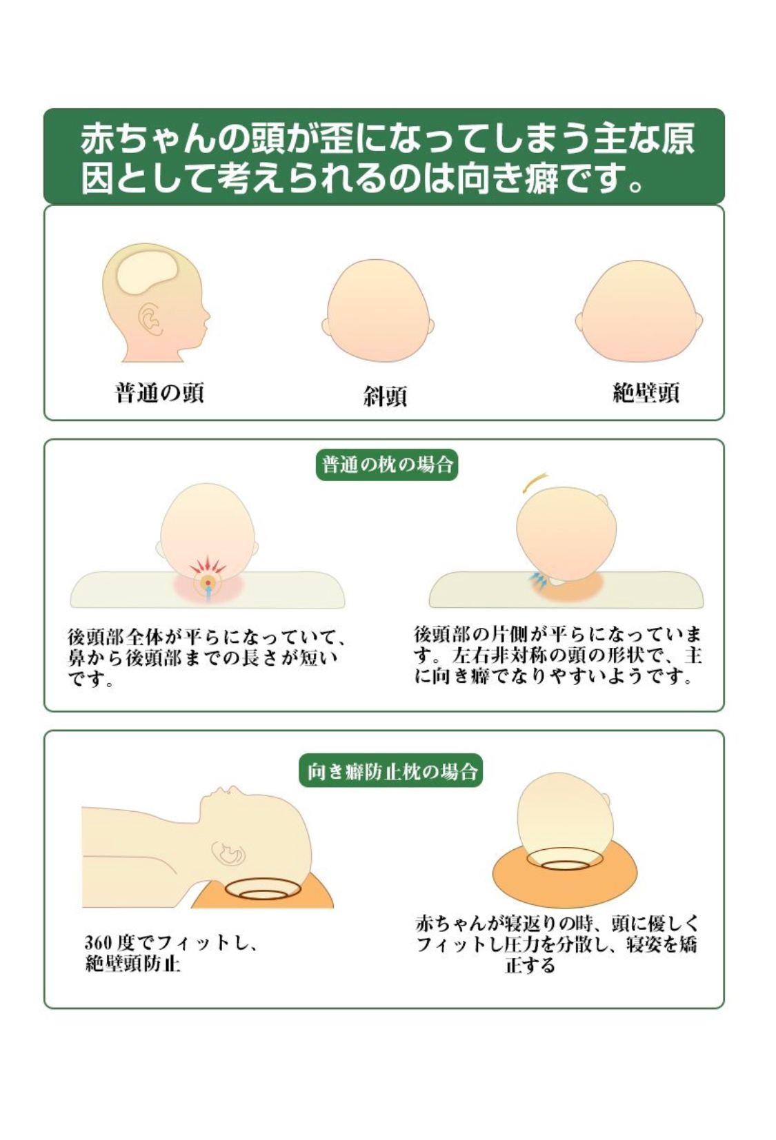 Adokoo婴儿枕头防变形枕絶壁头斜头吐奶防驼背矫正睡姿头形 淘宝网