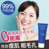 Восстанавливающий увлажняющий осветляющий гель алоэ вера от черных точек подходит для мужчин и женщин, анти-акне, контроль жирного блеска, скрывает прыщи