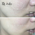 Mạnh Medrepair Medrepair Miert Powder Multi-Essence Sửa chữa nước Up Up Light Moisturizing Toner Moisturising innisfree đất sét 