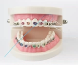 Купить 2 Дайте 1 Love Dental Dental Dental Direction Line Line Orthodontic Container Curret