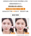 Korea rnw Ruwei Hyaluronic Acid Essence Facial Concentrate Moisturizing Original Liquid Moisturizing Replenishing Shrink Pore Chính hãng 30m serum goodndoc b5 