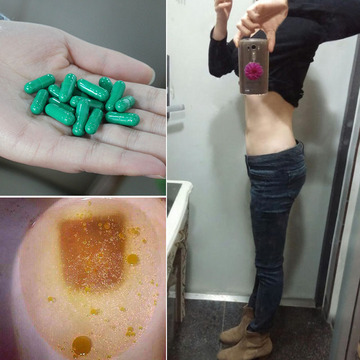 排油丸减脂胶囊化脂烧脂肪顽固性 刮肠油通便润便