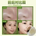 Kem dưỡng da mặt Lan Kexin Kem dưỡng da mặt Facial Pore Cleansing Cream Facial Moisturizing to Blackheads to Yellow