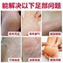 Bộ phim chân 3 cặp lột tẩy tế bào chết già dưỡng ẩm giữ ẩm làm trắng da chết cũ 茧 chăm sóc bàn chân nuôi dưỡng dưỡng ẩm chân phim tẩy da chết bàn chân Trị liệu chân