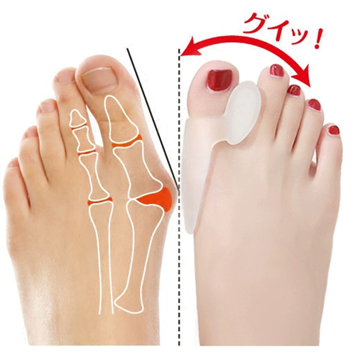 Ортезы для пальцев на ноге, лечение вальгусной деформации большого пальца стопы подходит для мужчин и женщин, для большого пальца ноги