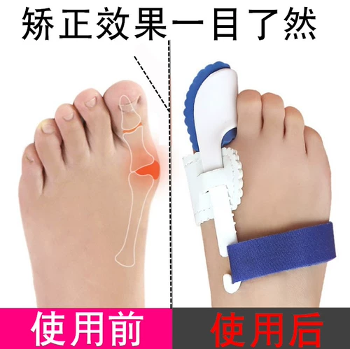 Лечение вальгусной деформации большого пальца стопы, ортезы для пальцев на ноге подходит для мужчин и женщин, для большого пальца ноги